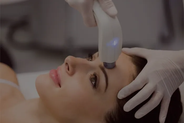 Advanced skin laser treatment at Brightonic, Dwarka